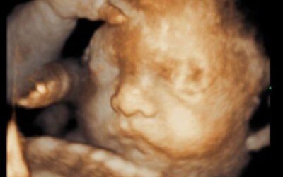 Ultrasonido 4D: una experiencia única para las mamás