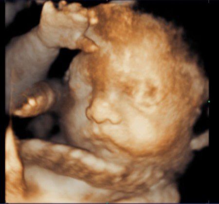 Ultrasonido 4D: una experiencia única para las mamás