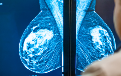 Ultrasonido 4D: una experiencia única para las mamás